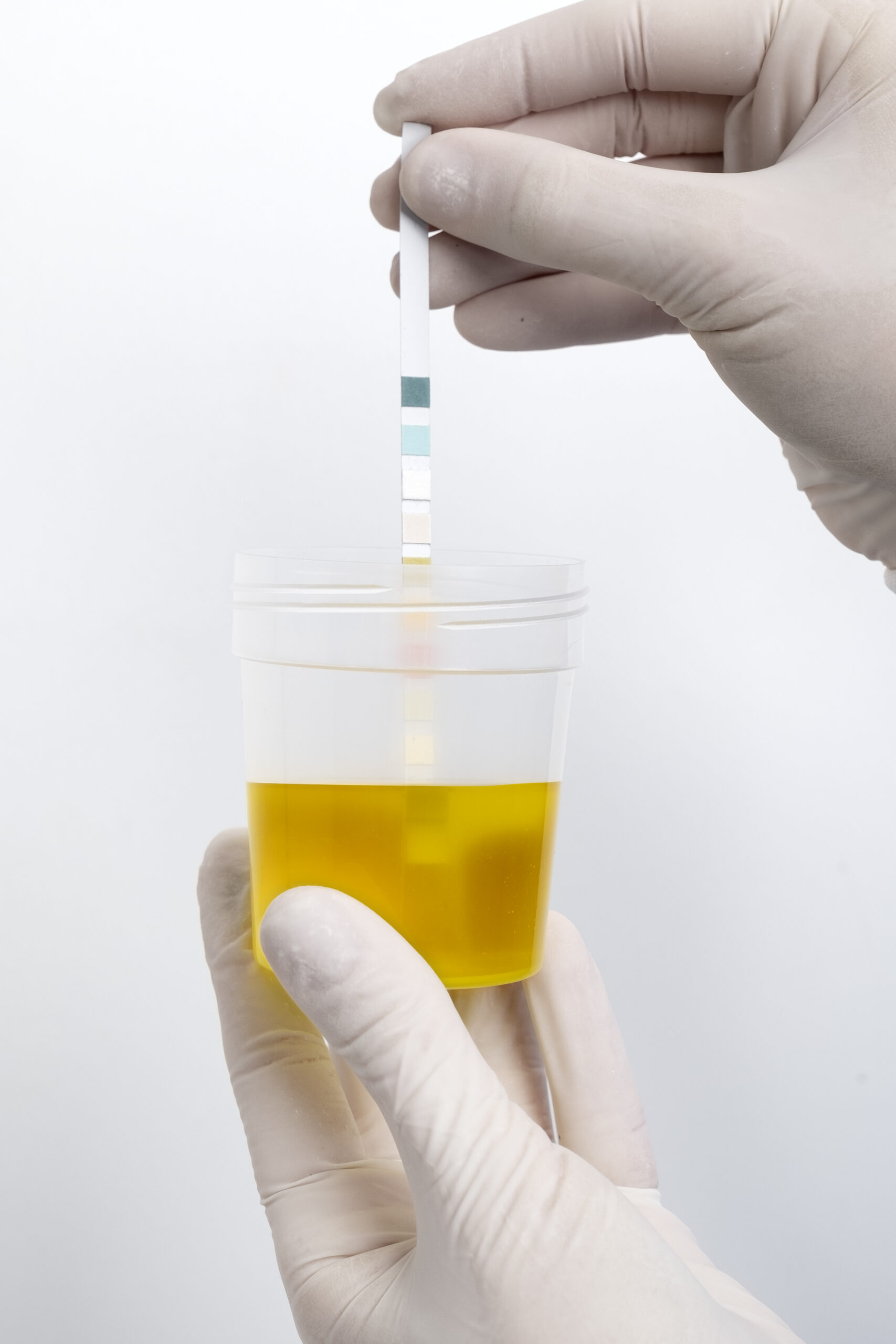Isothiazolinone Biocidas Evaluación Y Pronóstico De Oportunidades De Mercado Para 2030